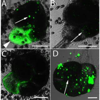 Laser Scanning Confocal Micrographs Of Three A Aomoriensis Specimens