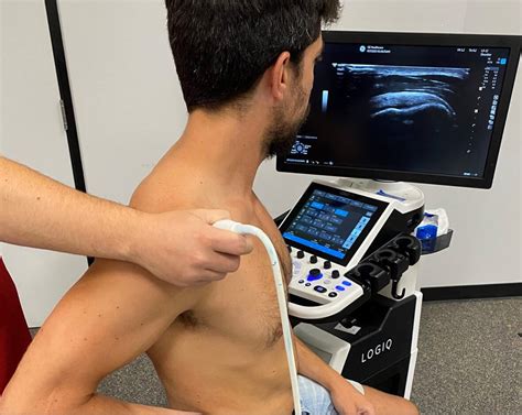 Shoulder Ultrasound Scans A Comprehensive Guide