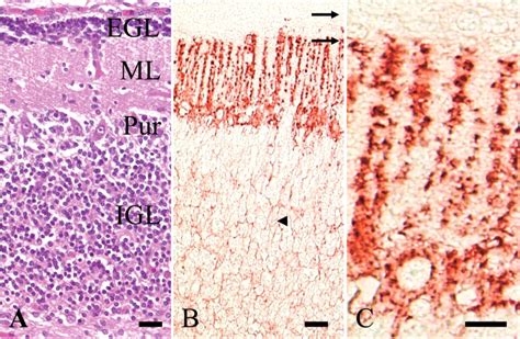 Purkinje Cells Histology