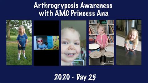 2020 Arthrogryposis Awareness With Amc Princess Ana Day 25 Youtube