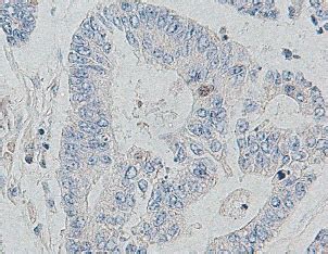 Cten Immunostaining In Non Neoplastic Colorectal Diseases A X