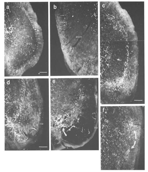 D Field Photomicrographs Of Transverse Sections Through The Mdh