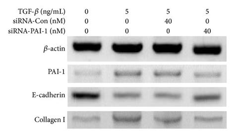 Pai Knockdown Inhibits The Tgf Promoted Emt In La Cells A