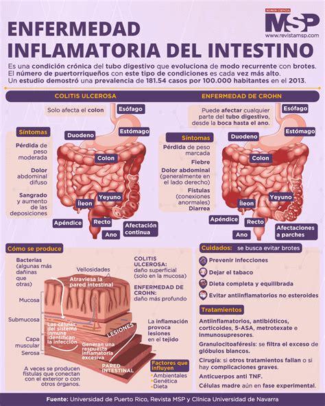 Enfermedades Inflamatoria Intestinal Mind Map Porn Sex Picture