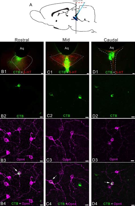 Retrograde Labeling Of Drn Projecting Retinal Ganglion Cells A The