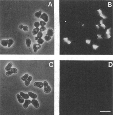 Fluorescence And Phase Contrast Micrographs Of Wildtype A And B And