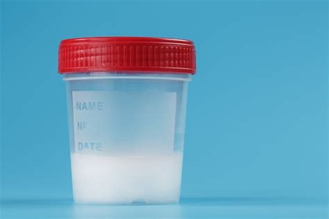 Premium Photo Semen In A Test Container With A Red Lid On A Blue