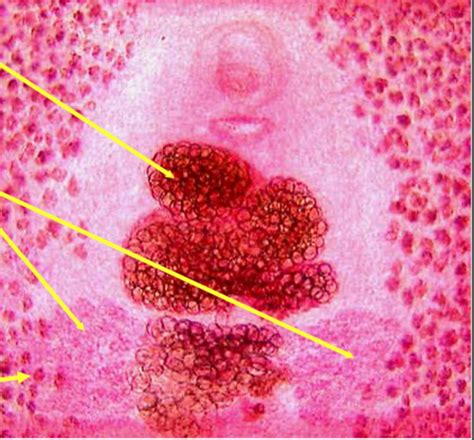 Parasitology Exam 3 Flashcards Quizlet