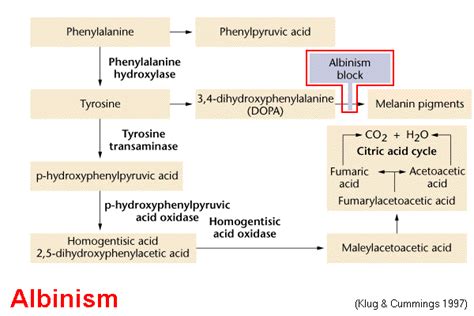 Albinism
