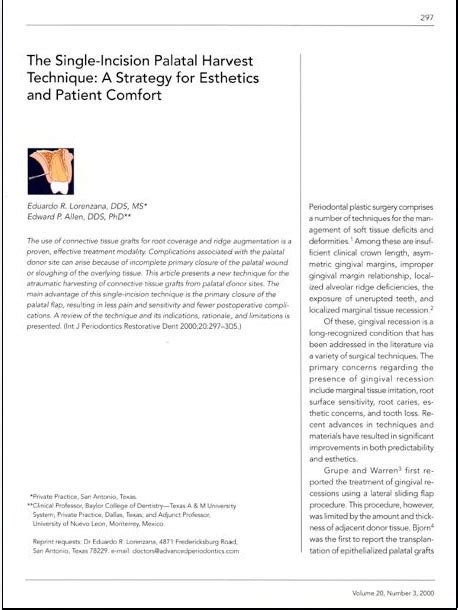 The Single Incision Palatal Harvest Technique A Strategy For Esthetics