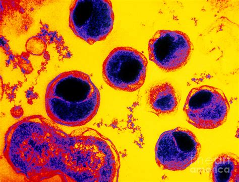 Colored Tem Of Chlamydia Sp Bacterium Photograph By David M Phillips