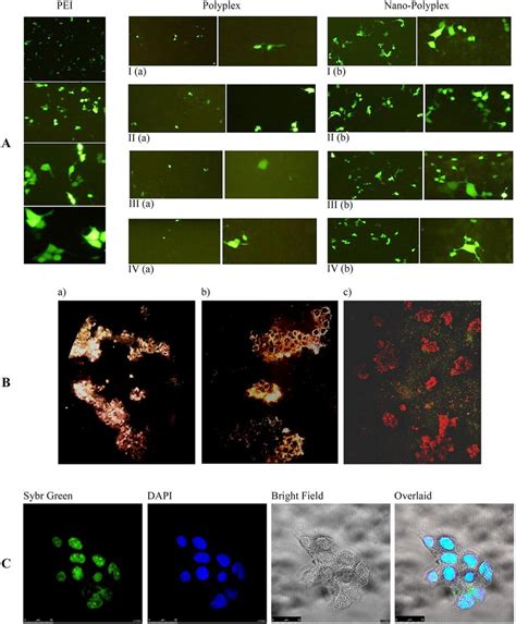 Comparison Of Transfection Of PDNA PEI N P Ratio Of 10 With