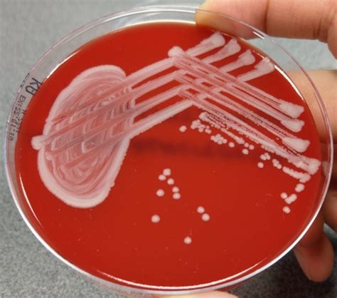 Colony Morphology Flashcards Quizlet