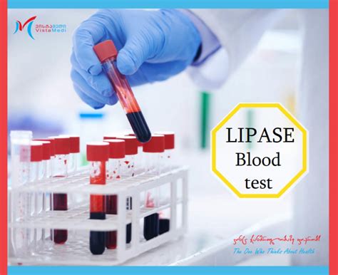 Lipase – Vistamedi