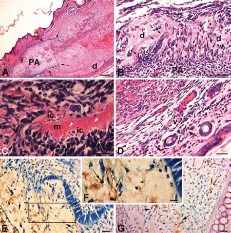 Photomicrographys Of Transplants Of Adult Apical Papilla Dpt