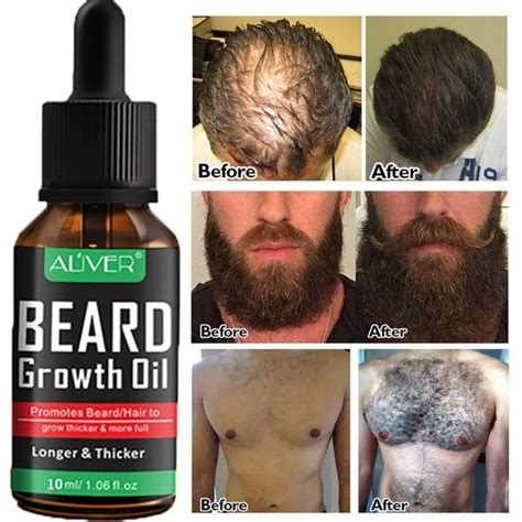 Best Hair Growth Beard Oil Barbershopbeard