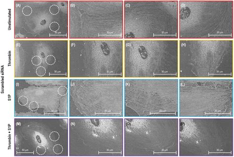 Sem Images Of Actin Filament Structures Of A Single Lung Ec Transfected