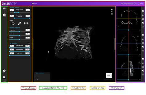 How To Visualize Dicom Files In 3d On 3dicom Randd 3dicom Viewer