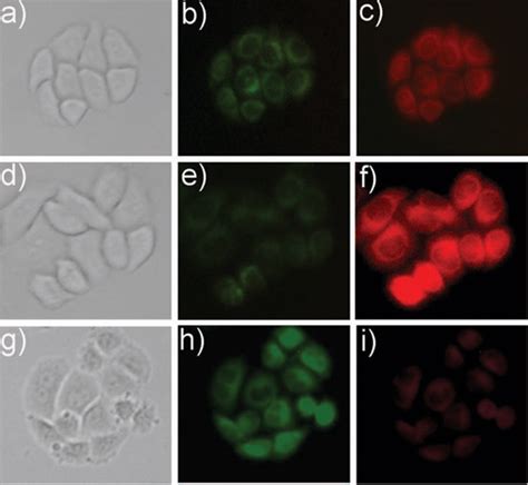 Ratiometric Fluorescent Detection Of Intracellular Hydroxyl Radicals