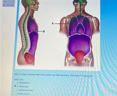 Solved Here Is A Figure Showing Major Body Cavities And
