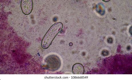 Bacteria Under Microscope 100x Stock Photo 1086668549 | Shutterstock