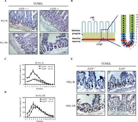 Figure From Paradoxical Roles Of Elongation Factor Kinase In Stem