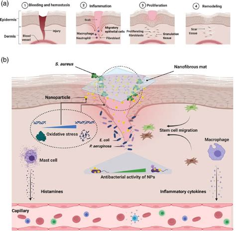 Schematic Illustration Of A Wound Healing Stages Diagram B