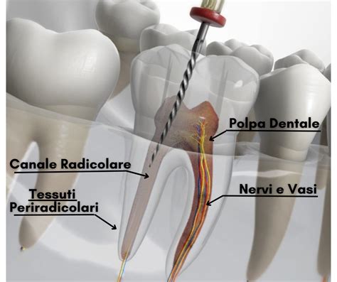 Dolore In Un Dente Devitalizzato Cause E Soluzioni Centro