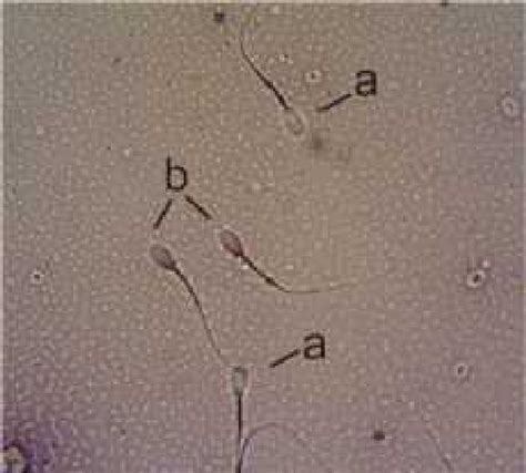 The Evaluation Of The Spermatozoa Under A Microscope At 400x Download Scientific Diagram