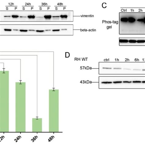 Differences In Vimentin MRNA And Protein Expression In Various Mouse