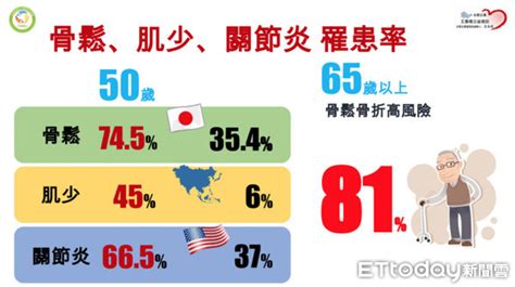 身高縮3cm、毛巾擰不乾 長輩「4大徵兆」骨鬆肌少症上身 Ettoday旅遊雲 Ettoday新聞雲