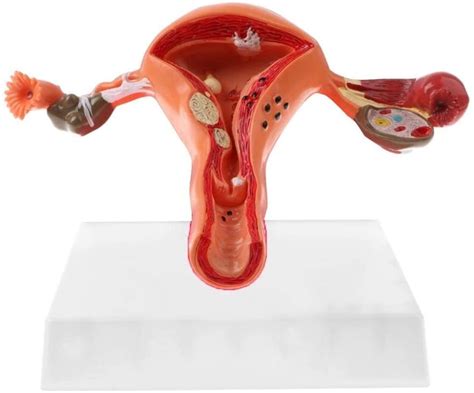 Buy PIAOLIGN Body Model 1pc Female Ovary And Uterus Disease Dissection