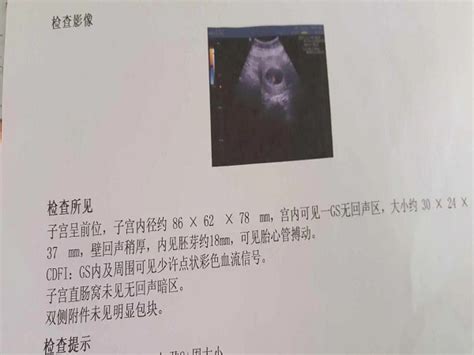 卵黄囊及胚芽大小孕周对照表，孕几周可见看这里就知道家庭医生在线