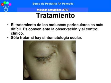 PPT Molusco Contagioso 2010 PowerPoint Presentation ID 944521