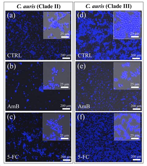 Confocal Laser Micrographs Of Violet Filipin Blue Stained C Auris