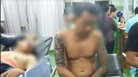 Satu Dari 4 Korban Penebasan Di Bali Akhirnya Meninggal Dunia Setelah