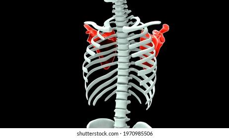 Diagram Deformation Cervical Vertebrae Neck Spasm Stock Vector (Royalty ...