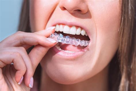 5 Ways To Make The Most Of Your Invisalign Treatment All Bright Dental