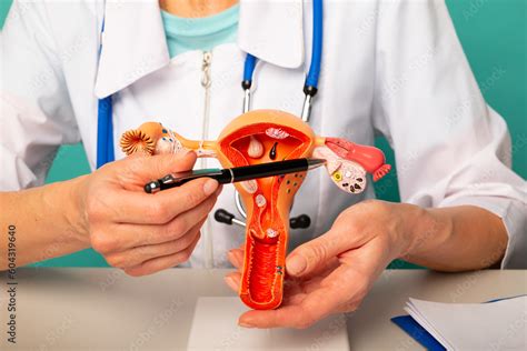 Doctor Gynecologist Showing Pen On Plastic Model Of Uterus And Ovaries