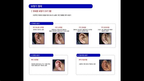 소음성난청 청각장애진단 청력검사 의정부 보청기수리 Hearing Aid Repair 제공으로 타업체 구매한 보청기도 수리