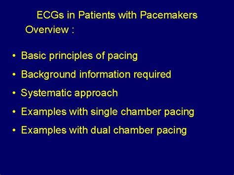 Ecg In Pacemaker Malfunction Sriram Rajagopal Southern Railway