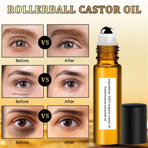 Roll On Castor Oil And Eye Oil Eraser For Under Eye Puffiness And Dark