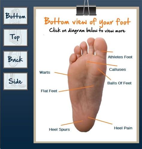 Foot Pain Diagnosis Chart