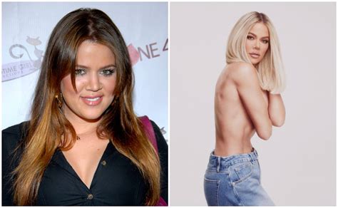 Khloé Kardashian así ha cambiado su cara con el tiempo Revista Clase