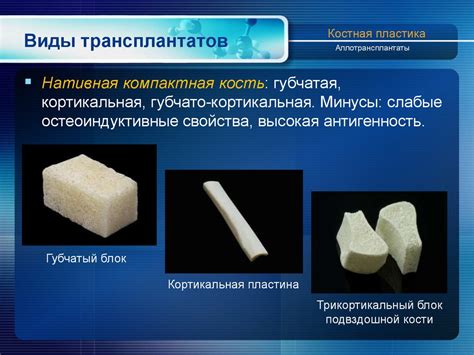 Костная пластика - презентация онлайн