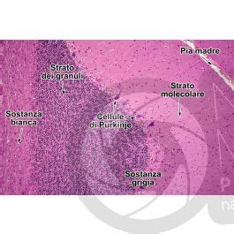 Uomo Cervelletto Sezione Sagittale X Uomo Mammiferi Sistema