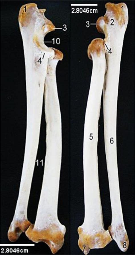 Lion Ulna And Radius Medial And Lateral Views 1 Olecranon Tuber 2