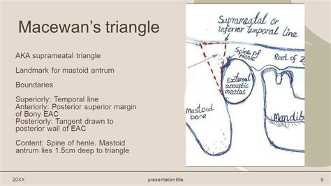 Named Signs Syndromes Tests Procedures And Structures In Ent Dr