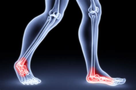 Choosing an Orthopedic Surgeon in Birmingham, AL | Health Blog Plus