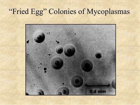 Ppt Mycoplasma And Ureaplasma Powerpoint Presentation Free Download Id 1758789